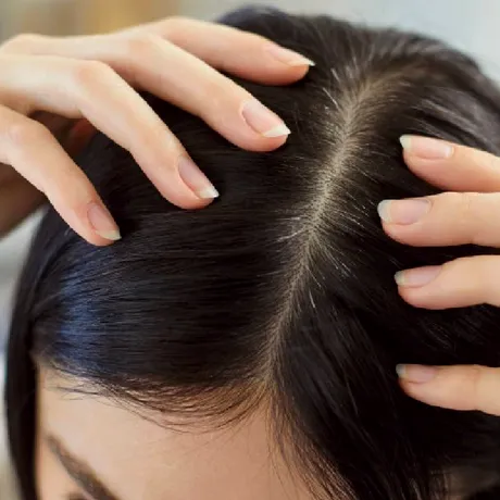 De ce îți cade părul: cauze mai puțin evidente pe care le ignori