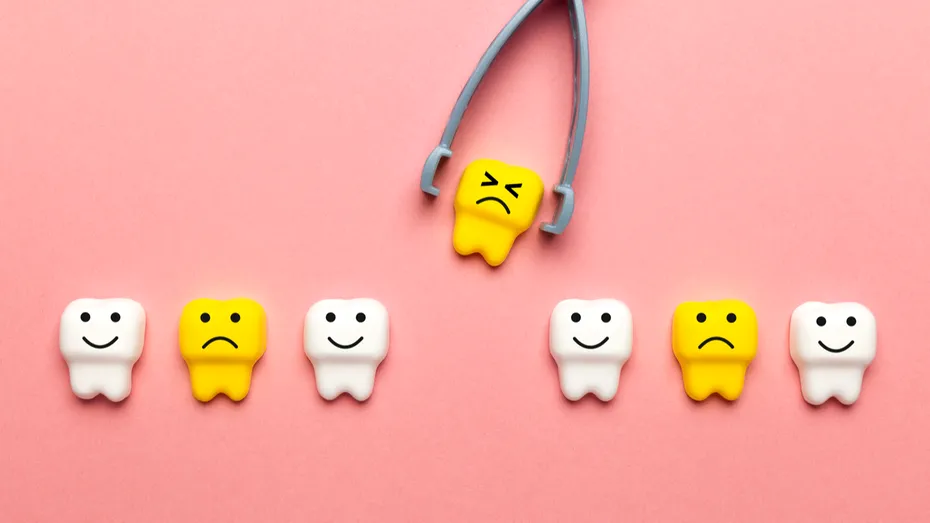 Pierderea dinților declanșată de stres. Cum evităm această situație