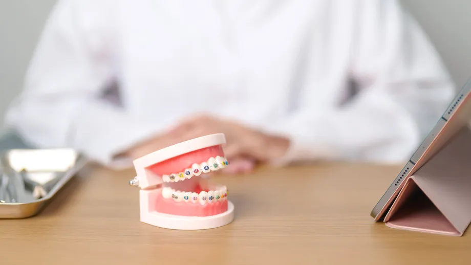 Cum putem preveni purtarea aparatelor dentare