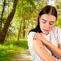 Primele minute după mușcătura de căpușă sunt cruciale. Ce trebuie să faci imediat