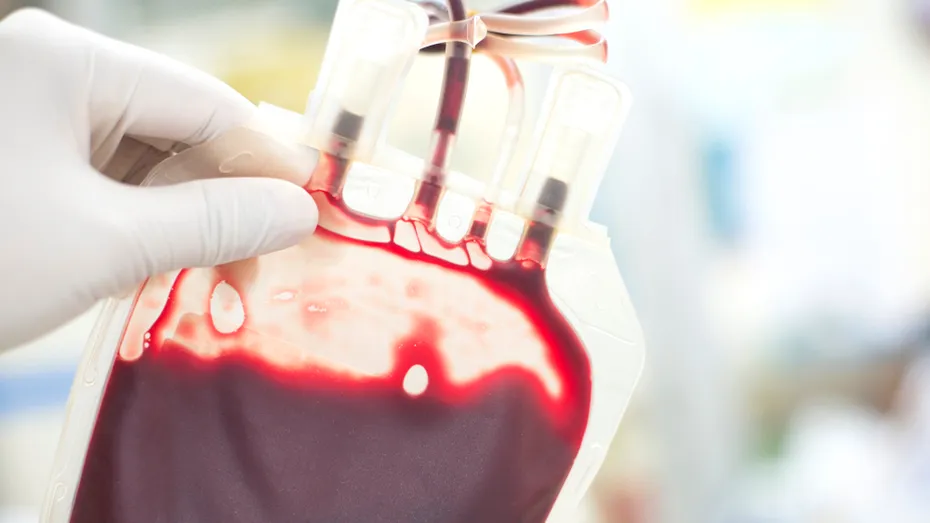 Ce boli riști în funcție de grupa de sânge. Persoanele predispuse la cheaguri de sânge
