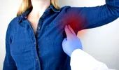 Cancerul de sân nu se manifestă întotdeauna printr-un nodul. Semnul de pe piele la care trebuie să fii atentă