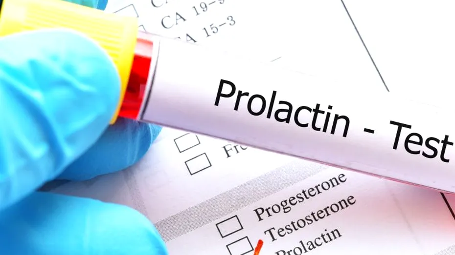 Deficitul de prolactină (hipoprolactenemie): cauze, simptome, tratament