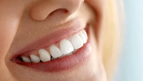 Sunteţi candidatul ideal pentru implant dentar?