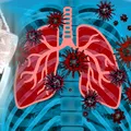 OMS avertizează că ar putea apărea noi cazuri de Hantavirus după focarul de pe nava MV Hondius. O pacientă din Franța este în stare gravă