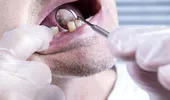 De ce nu se refac dinții singuri, așa cum se vindecă un os? Explicația medicului stomatolog Sorina Stroe!