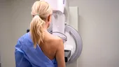De ce să nu sări peste prima mamografie — ce ar trebui să știi