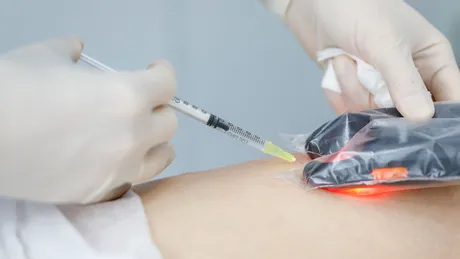 Obiceiuri zilnice care îți sabotează sănătatea venelor