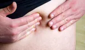 Pancreatita acută explicată pe înțelesul tuturor. Când devine periculoasă durerea abdominală