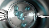 Testele genetice pe embrioni: cum se fac şi cui sunt recomandate