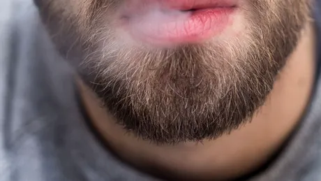 Leucoplaziile buzelor (leucoplazia sau leucoplakia bucală): cauze, simptome, tratament