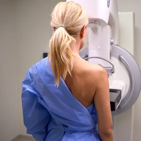 De ce să nu sări peste prima mamografie — ce ar trebui să știi