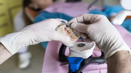 Stomatologul care și-a mutilat pacienții: le scotea dinții sănătoși ca să le pună proteze scumpe. Câștiga 80.000 de euro pe lună