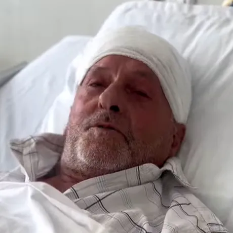 Un bărbat din Neamț i-a șocat pe medici. A ajuns la spital paralizat pe jumătate și fără să poată vorbi! Ce avea, de fapt, în creier
