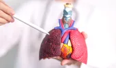 Cancerul pulmonar nu afectează doar fumătorii. Medicul explică factorii de risc pe care mulți îi ignoră