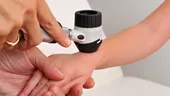Testări dermatologice gratuite în luna iunie, în trei județe din România. În ce date au loc