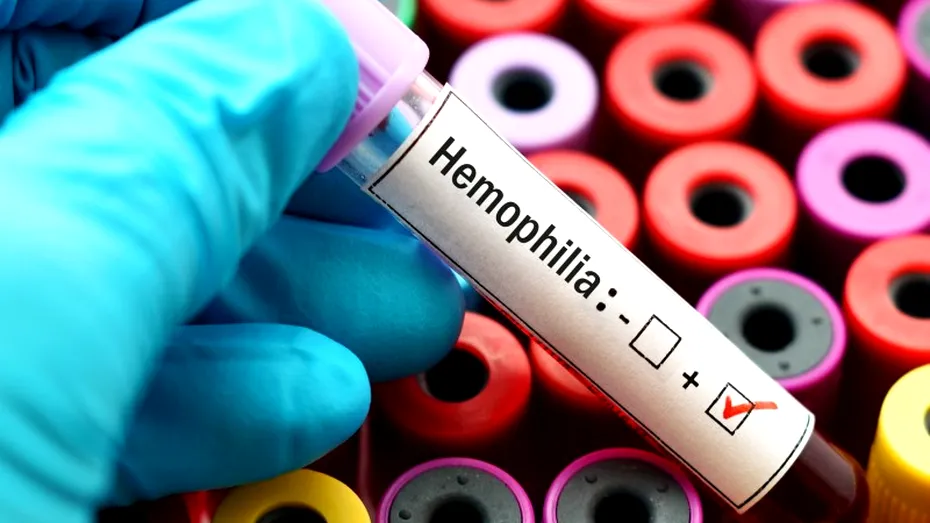 Hemofilia: simptome, tratament