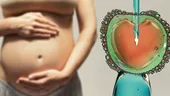 Inseminare intrauterină sau fertilizare in vitro? O alegere ghidată de cauzele infertilitatii, nu de preferințe