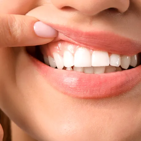 Cum să obții dinți mai albi acasă. Rețeta naturală pentru un zâmbet ca la Hollywood