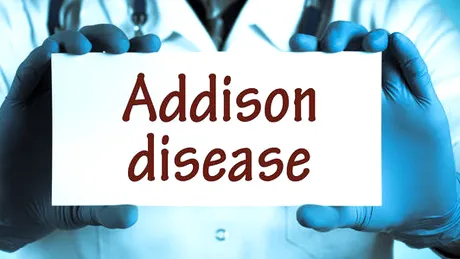 Boala Addison: simptome tratament