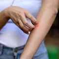Avertisment de la specialiști! Virusul tropical fatal care poate ajunge în Europa. Cum se transmite?
