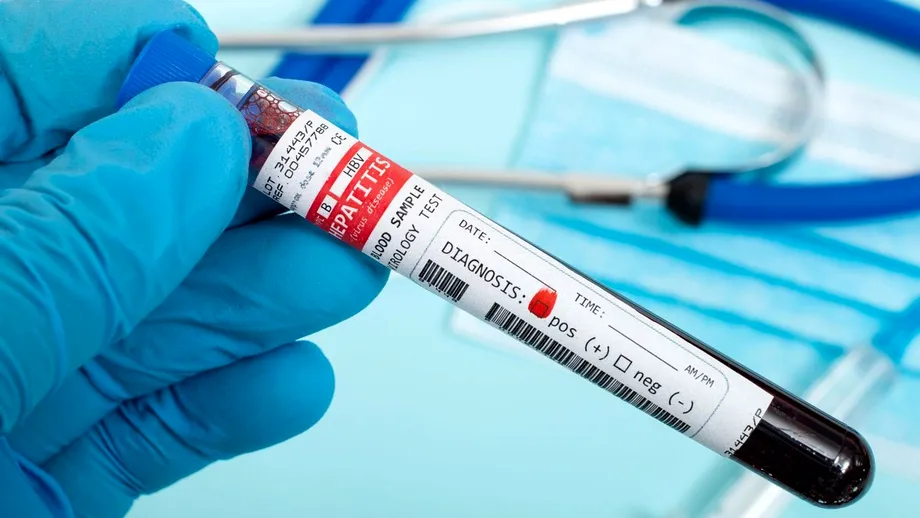 Alaninaminotransferaza (ALT) mărită: cauze și soluții