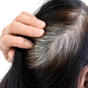 Scapi de părul alb în câteva secunde, fără vopsea. Trucul care te întinerește cu 10 ani