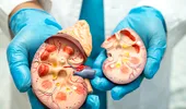 Apa pe care mulți români o beau zilnic poate crește riscul unor forme de cancer. Avertismentul unui medic urolog