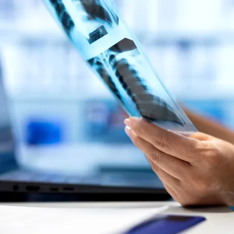 Obiectul misterios descoperit de un medic chirurg în colonul unui pacient, pe masa de operație: „M-a înțepat în deget”