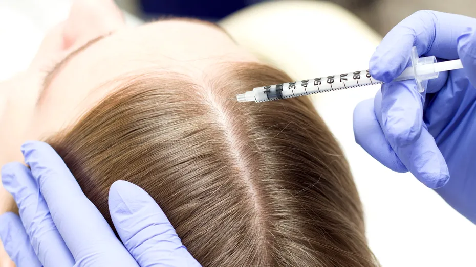 Injecția care ar putea împiedica procesul de chelire