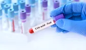 De ce poate crește brusc acidul uric? Factorii ascunși care pot declanșa guta