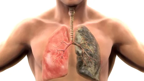 La cât timp după ce te lași de fumat se curăță plămânii de tutun