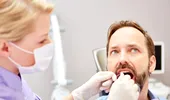 13 mituri despre parodontoză cu Dr. Catrinel Banu, medic dentist specialist
