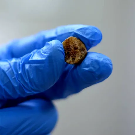 Adio, pietre la fiere! Alimentul de origine animală care poate reduce riscul de calculi biliari. Stimulează golirea vezicii biliare