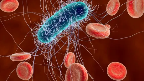 Infecţia cu E.coli - simptome, cauze, tratament