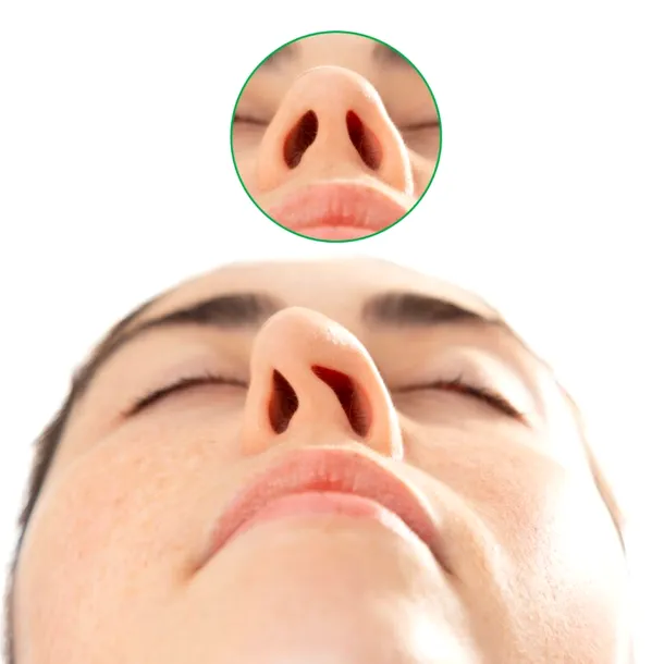 Rinoseptoplastia, operația 2 în 1: corectează aspectul nasului și deviația de sept