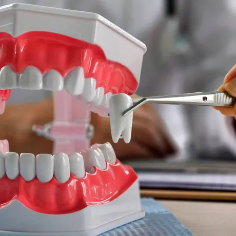 Sănătatea gurii este esențială pentru sănătatea întregului organism. 11 moduri în care afecțiunile dentare îți influențează starea de bine