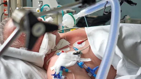 Ventilaţia pulmonară artificială la pacienţii cu forme severe de COVID-19