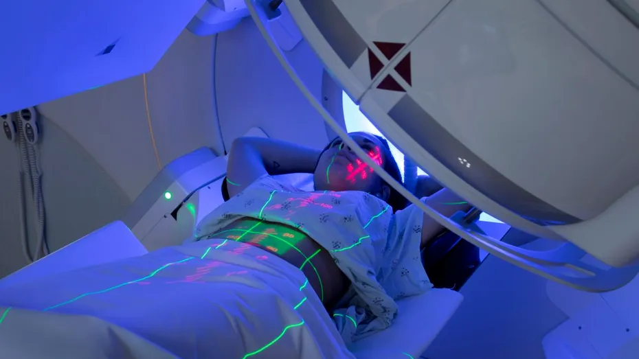 Cum funcționează radioterapia stereotactică, terapia interzisă românilor bolnavi de cancer