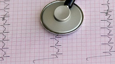 Care este viitorul bolnavilor de hipertensiune arterială