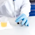 Ce îți poate spune culoarea urinei despre sănătate. Semnele care pot indica probleme ale rinichilor sau ficatului