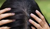 Cum să previi sau să întârzii albirea părului. De ce albește părul