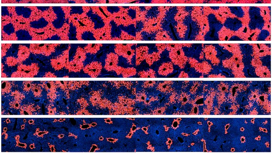 Celulele care ajută la regenerarea ficatului, localizate de oamenii de știință