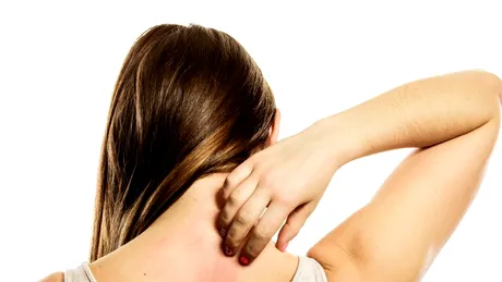 Dermatomiozita: cauze, simptome, tratament