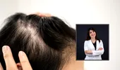Cauzele reale ale căderii părului la femei și bărbați. Când să mergi la medic