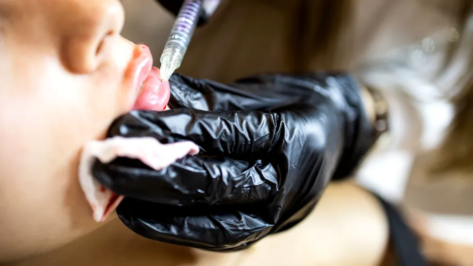 O studentă la Medicină din Sibiu făcea intervenții estetice chiar la ea acasă, fără să aibă drept de practică!