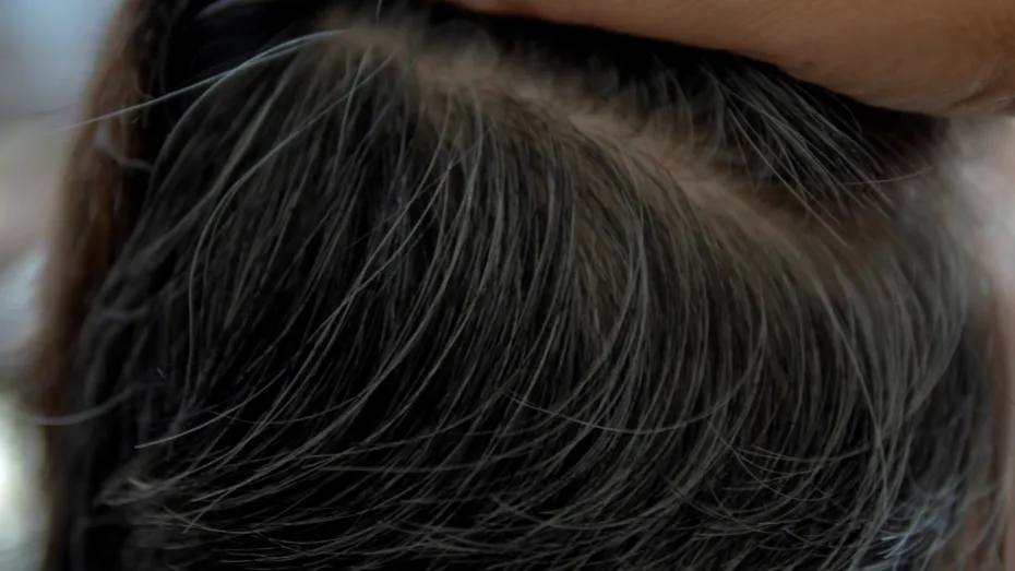 Mit sau realitate: crește mai mult păr dacă smulgi un fir alb? Ce spun specialiștii