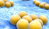 Staphylococcus aureus (stafilococul auriu) – ce este, ce simptome apar, când este periculos pentru sănătate și cum se tratează. Explică dr. Tatiana Popescu