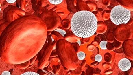 Leucemia mieloidă cronică, boala care atacă pe nepregătite!