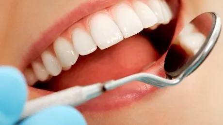 8 cauze ale căderii dinţilor